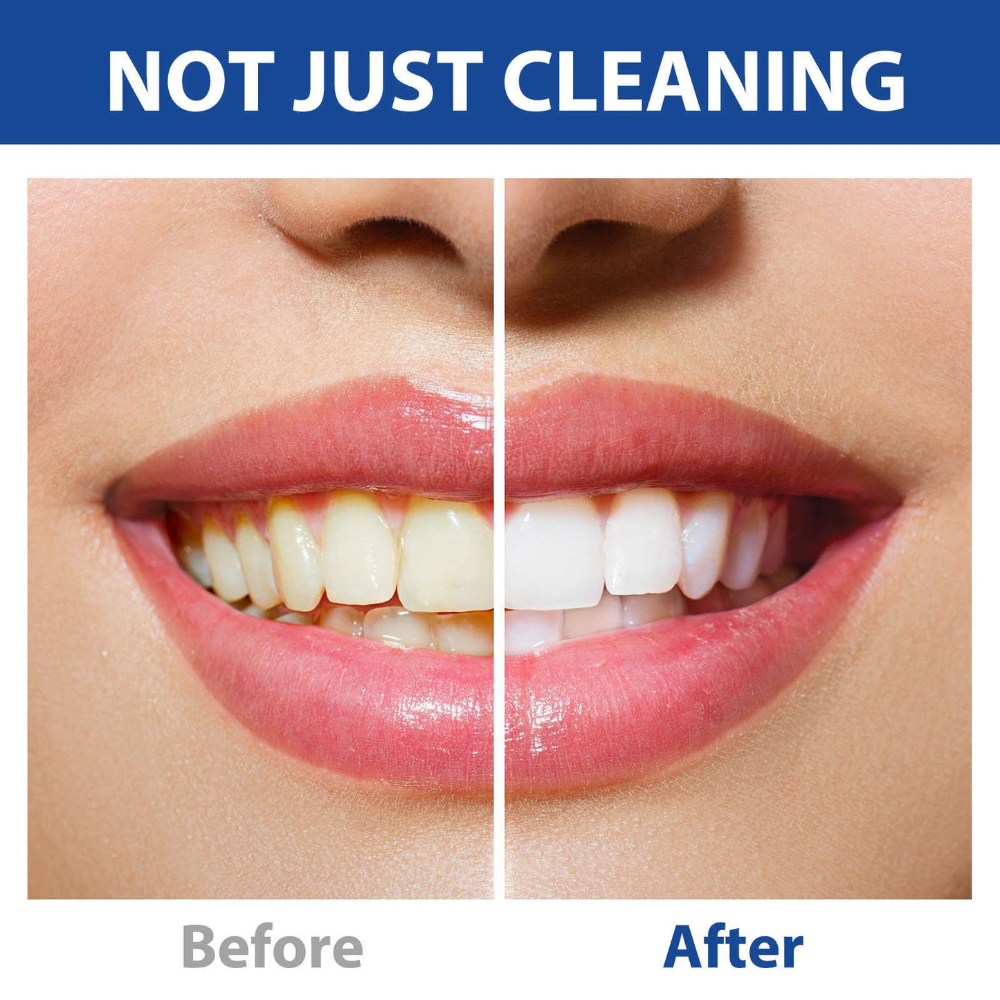 Benvoro™ NO-B Toothpaste Tablets
