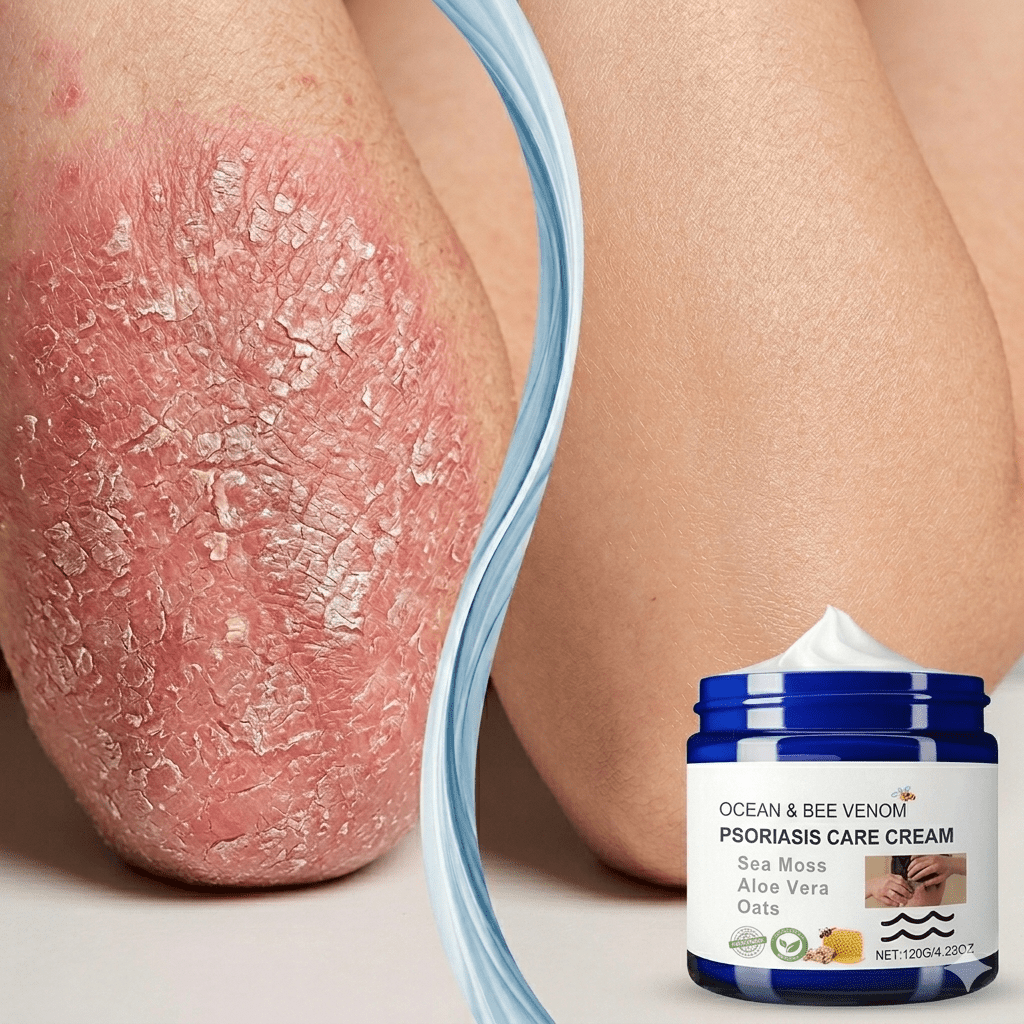 Benvoro™ Eczema & Skin Relief Cream For Children & Adults